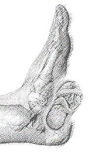 Maternity Reflexology. Susanne Master Baby Foot